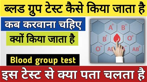 elisa test kaise kiya jata hai|alisa test in hindi.